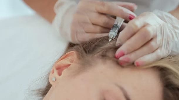 Hair Mesotherapy