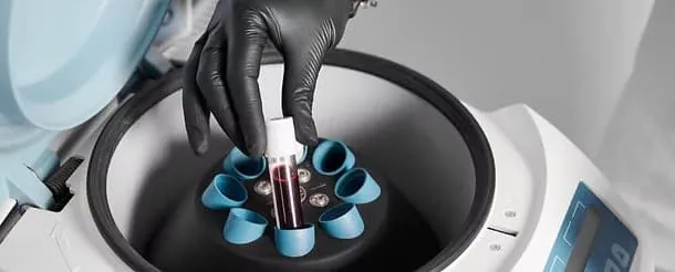 PRP Vaginal Rejuvenation