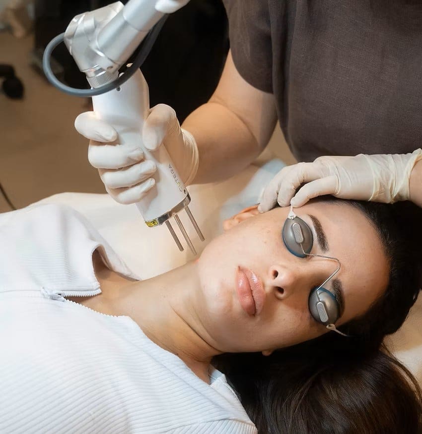 Pigmentation Laser Treatment