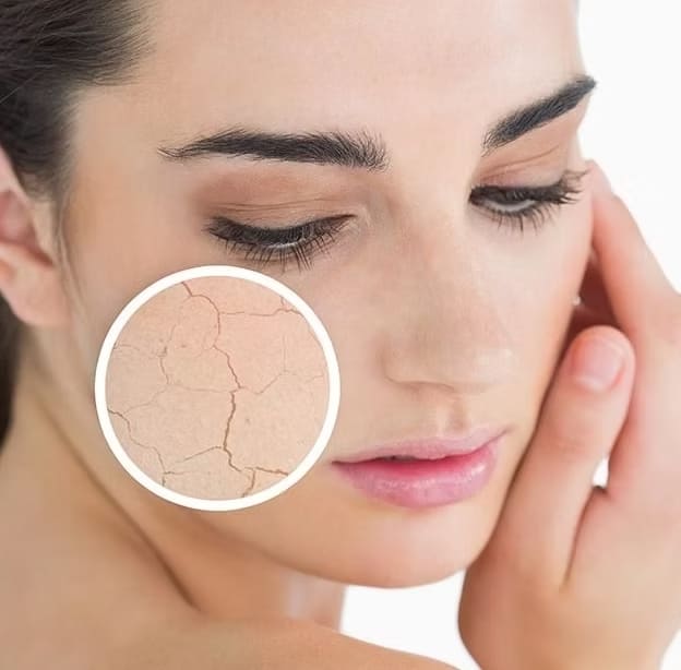 Dry, Sensitive Skin