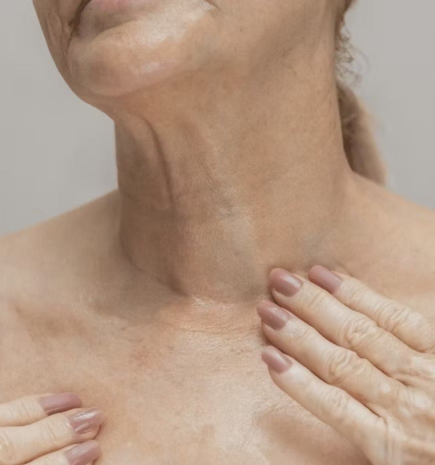 Sagging Neck and Turkey Neck