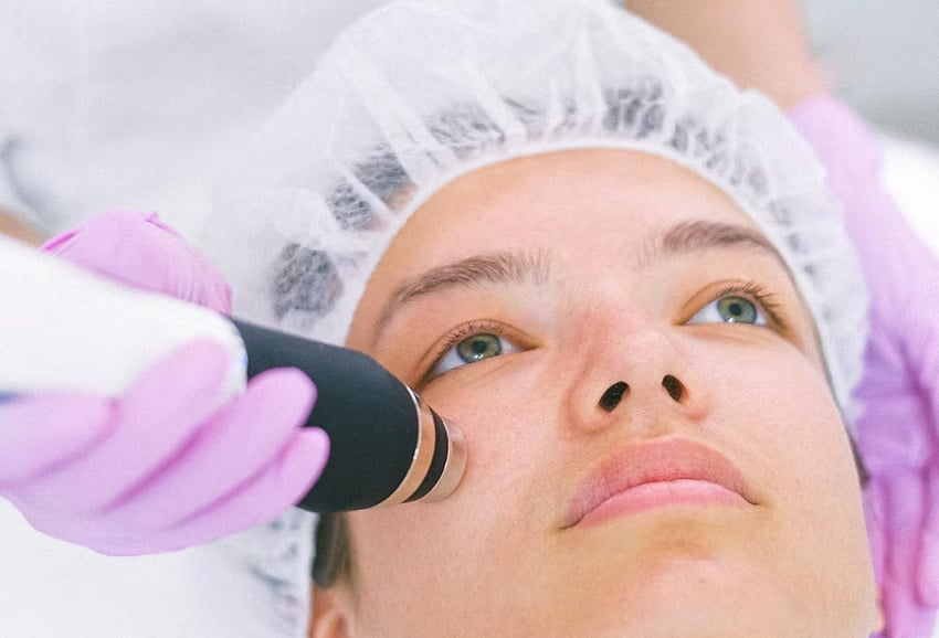 RadioFrequency Facials