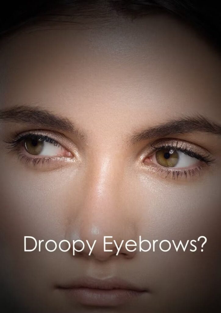 Eyebrow Sagging