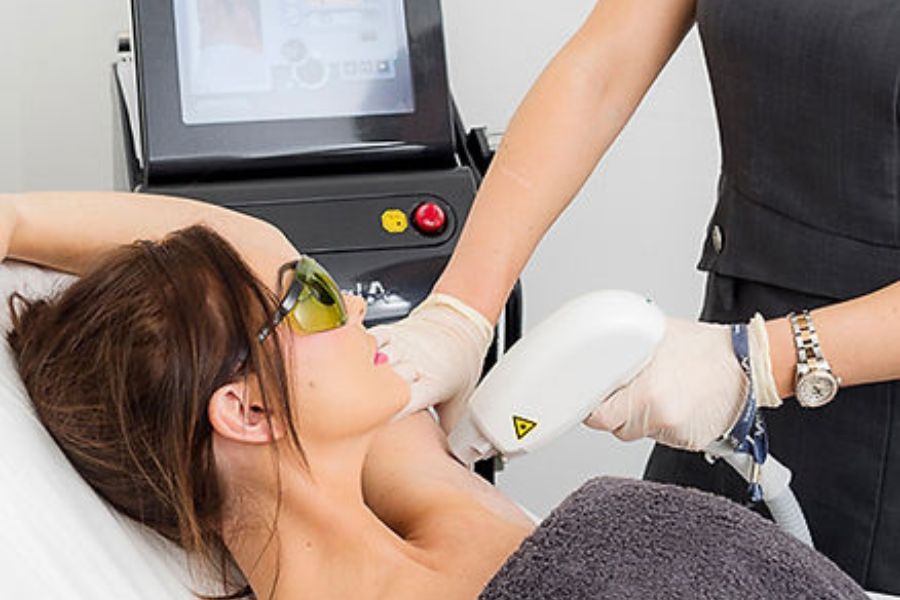 Soprano Ice Hair Removal at Skinoza Clinic: A Superior Choice in Orpington, Bromley, and Kent!