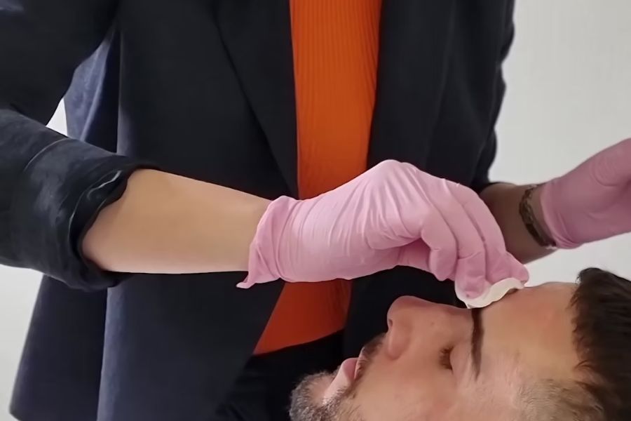 HarmonyCa Dermal Filler Review