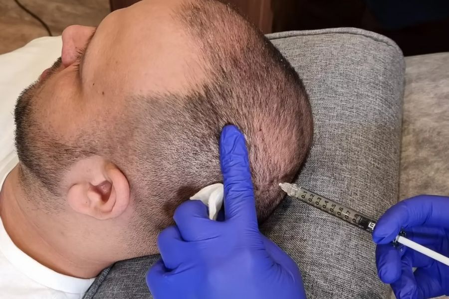 The Most Popular Aesthetic Treatments for Men