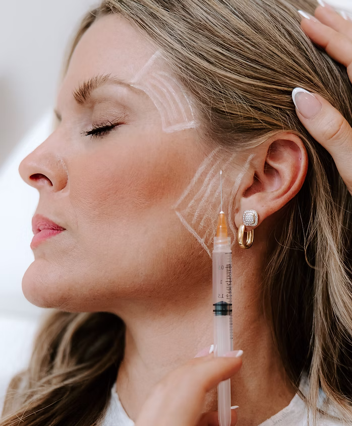 5 Side Effects of Sculptra Injections: What Can Go Wrong and What to Expect