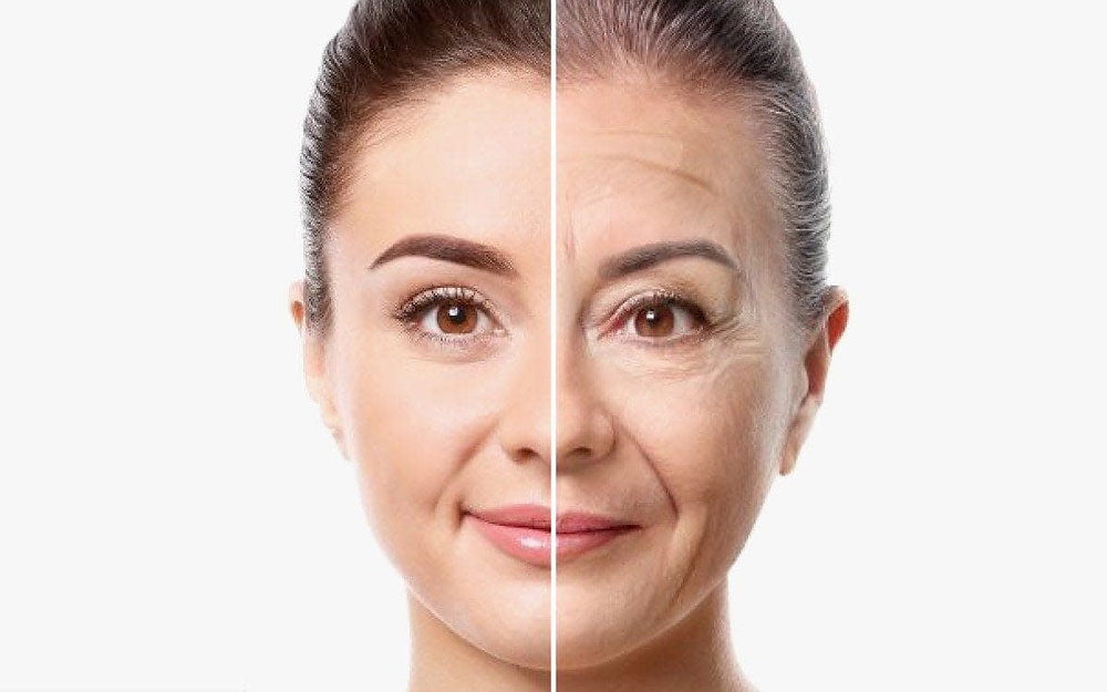 Mounjaro Face in London – How to Avoid Facial Ageing with Sculptra