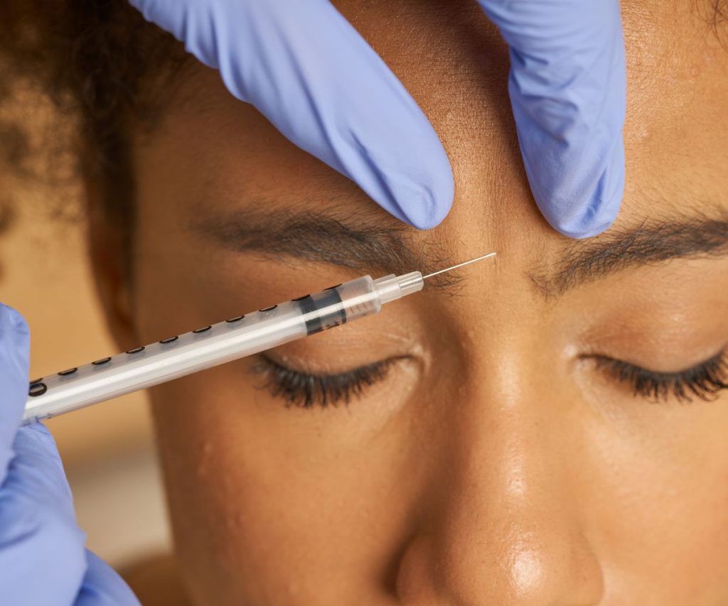 Botox for Chronic Migraine