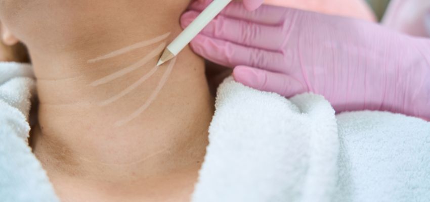 Sculptra for Neck Rejuvenation in the UK