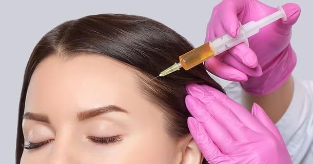 63732dc2e7df6722688383d9_Best-hair-filler-injection-Dubai