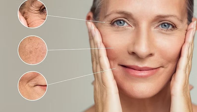 Aging Skin 3
