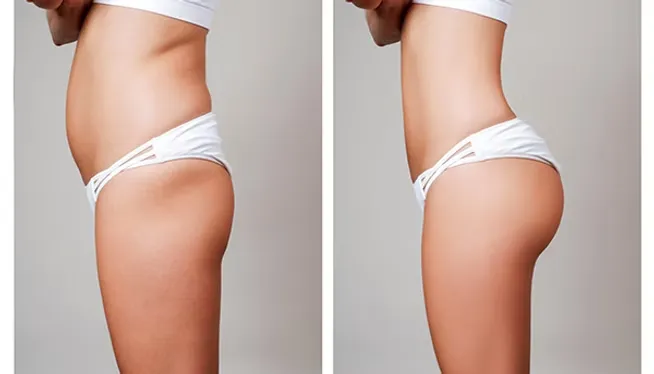 Bum Enhancement 2