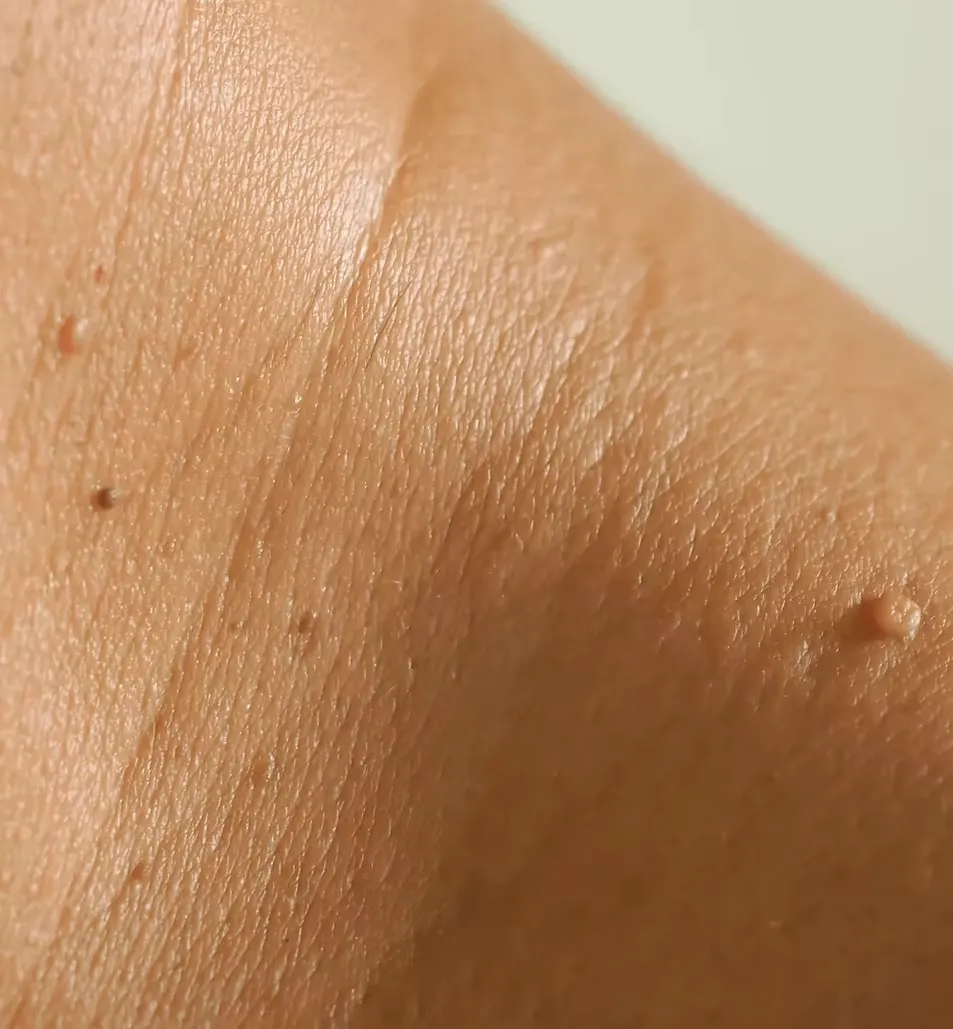 Moles 4
